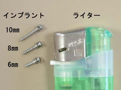 2020年 7月 歯科矯正用アンカースクリューを使用した矯正歯科治療