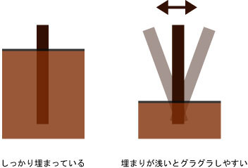 2014年10月　症例　入れ歯と歯周病と矯正治療　１