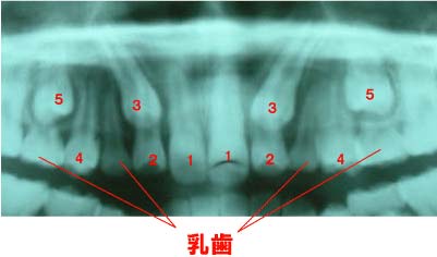 3DCTって何？